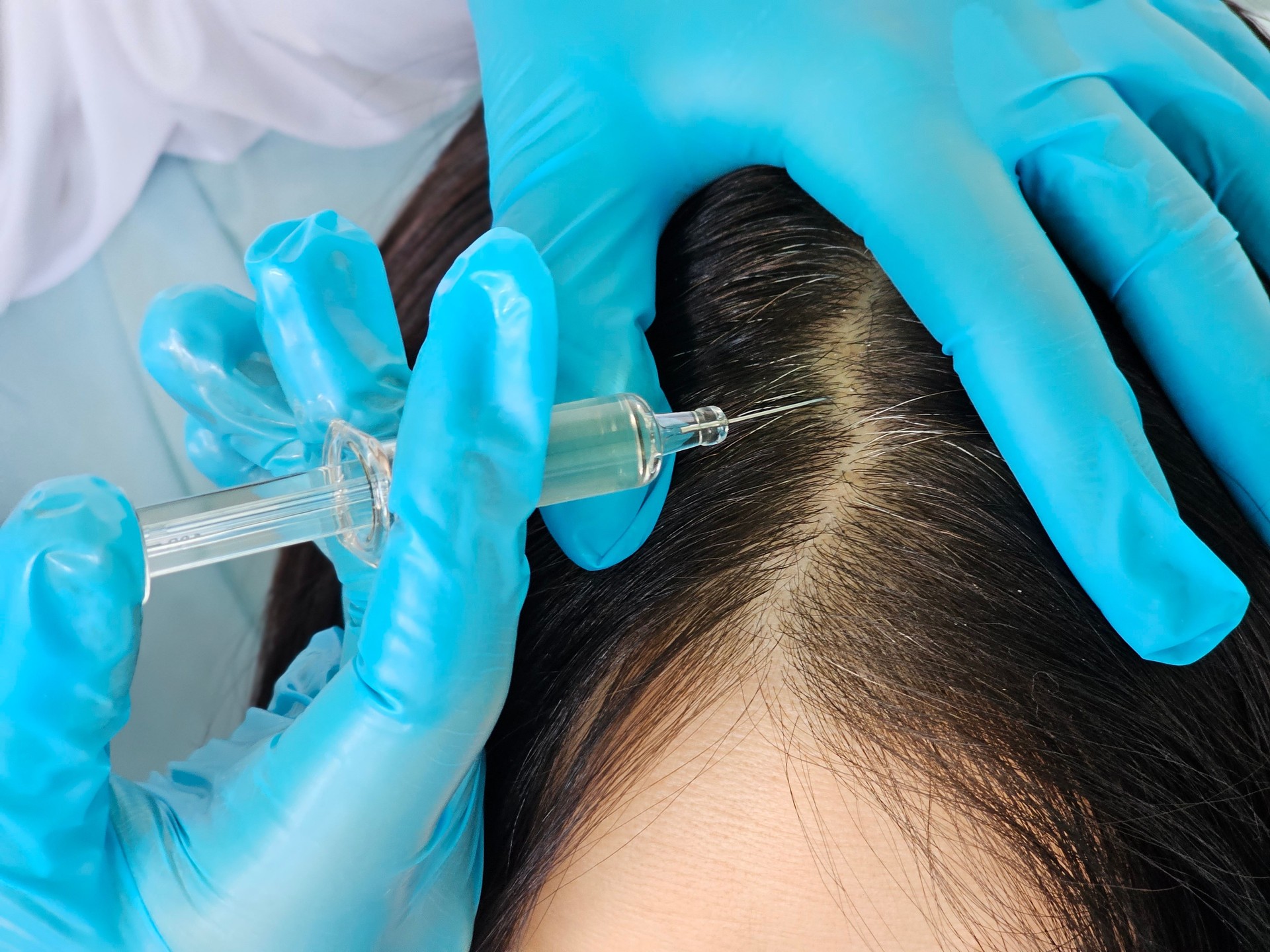 Scalp treatment session in a modern clinic with a focus on hair restoration techniques